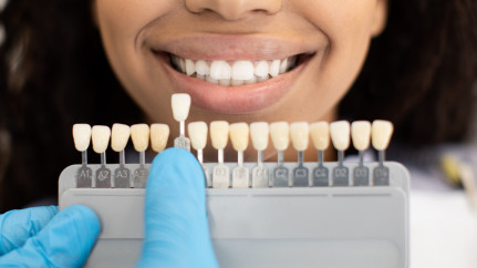 Implantate werden den natürlichen Zähnen exakt angeglichen